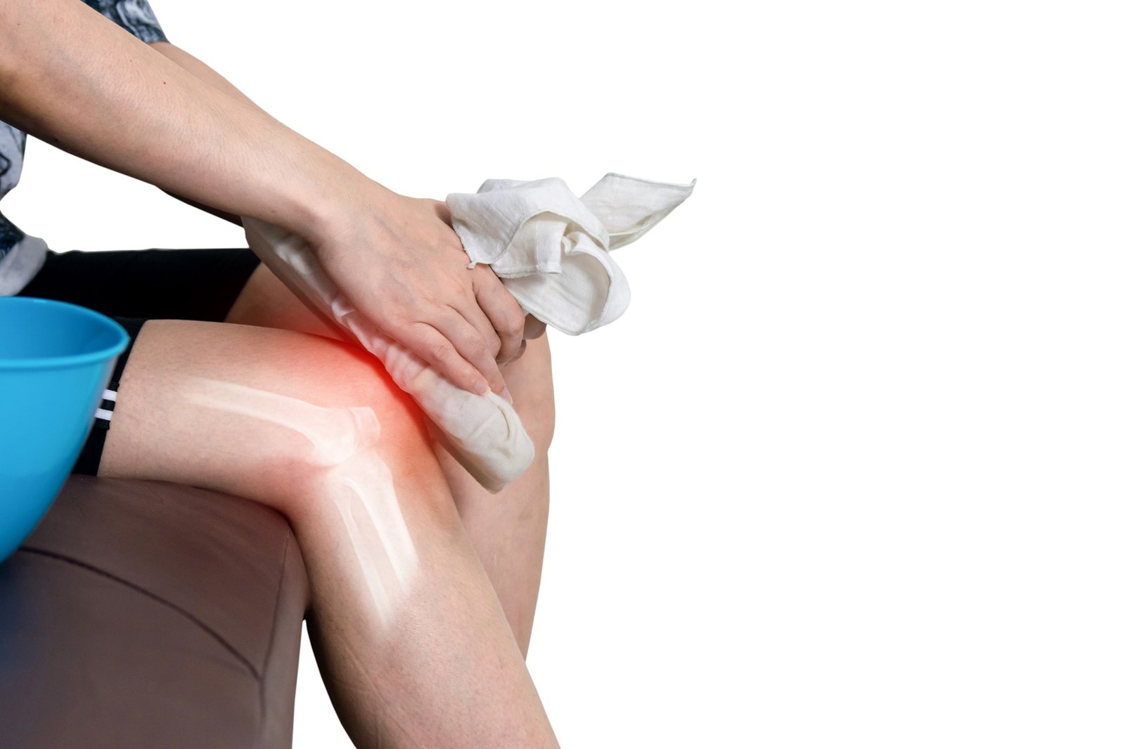 Human leg osteoarthritis inflammation of bone joints cold compre